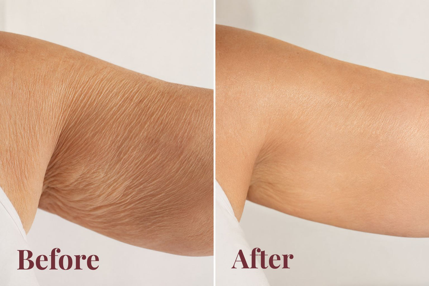 Toneva Anti-Aging Body Oil — Firms, Lifts & Restores Loose Skin